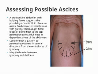 Assessing Possible Ascites
 A protuberant abdomen with
bulging flanks suggests the
possibility of ascitic fluid. Because
ascitic fluid characteristically sinks
with gravity, whereas gas-filled
loops of bowel float to the top,
percussion gives a dull note in
dependent areas of the abdomen.
 Look for such a pattern by
percussing outward in several
directions from the central area of
tympany.
 Map the border between
tympany and dullness.
 