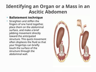 Identifying an Organ or a Mass in an
Ascitic Abdomen
 Ballotement technique
 Straighten and stiffen the
fingers of one hand together,
place them on the abdominal
surface, and make a brief
jabbing movement directly
toward the anticipated
structure. This quick movement
often displaces the fluid so that
your fingertips can briefly
touch the surface of the
structure through the
abdominal wall.
 