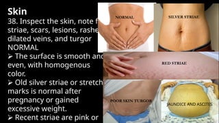 Stria Rash Abdominal Assessment for nursing students | PPTX