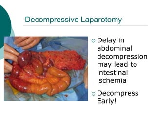 Decompressive Laparotomy

                   Delay in
                    abdominal
                    decompression
                    may lead to
                    intestinal
                    ischemia
                   Decompress
                    Early!
 