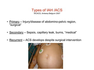 Wsacs Abdominal compartment syndrome and septic abdomen | PPTX