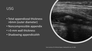 Abdominal disease | PDF