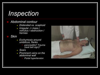 Inspection
 Abdominal contour
 Distended vs. scaphoid
 Irregular -> mass /
volvulus / obstruction /
hernias
 Skin
 Ecchymosis around
umbilicus, flanks
 pancreatitis? Trauma
(seat belt sign)?
 Scars
 Prominent veins on the
abdominal wall
 Portal hypertension
 