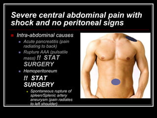 Severe central abdominal pain with
shock and no peritoneal signs
 Intra-abdominal causes
 Acute pancreatitis (pain
radiating to back)
 Rupture AAA (pulsatile
mass) !! STAT
SURGERY
 Hemoperitoneum
!! STAT
SURGERY
 Spontaneous rupture of
spleen/Splenic artery
aneurysm (pain radiates
to left shoulder)
 