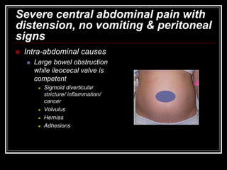 Severe central abdominal pain with
distension, no vomiting & peritoneal
signs
 Intra-abdominal causes
 Large bowel obstruction
while ileocecal valve is
competent
 Sigmoid diverticular
stricture/ inflammation/
cancer
 Volvulus
 Hernias
 Adhesions
 