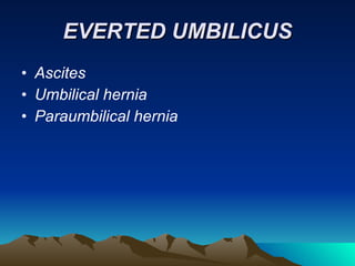 EVERTED UMBILICUS Ascites Umbilical hernia Paraumbilical hernia 