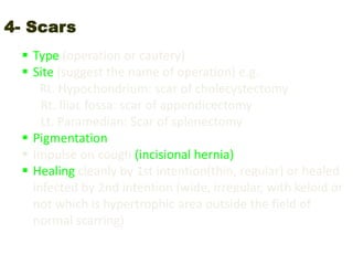4- Scars
 Type (operation or cautery)
 Site (suggest the name of operation) e.g.
Rt. Hypochondrium: scar of cholecystectomy
Rt. Iliac fossa: scar of appendicectomy
Lt. Paramedian: Scar of splenectomy
 Pigmentation
 Impulse on cough (incisional hernia)
 Healing cleanly by 1st intention(thin, regular) or healed
infected by 2nd intention (wide, irregular, with keloid or
not which is hypertrophic area outside the field of
normal scarring)
 