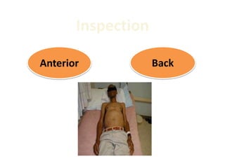 Anterior Back
Inspection
 