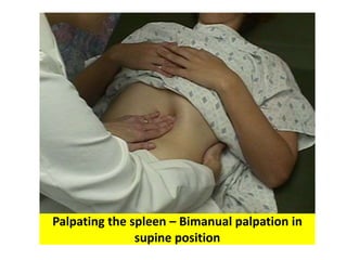 Palpating the spleen – Bimanual palpation in
supine position
 