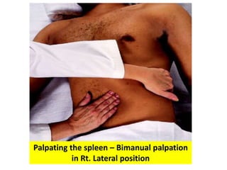 Palpating the spleen – Bimanual palpation
in Rt. Lateral position
 