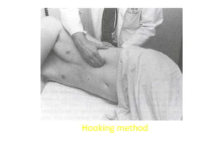 Examining for the spleen from behind the patient, in the right
lateral position. In this case, the fingers are "hooked" over the
costal margin.
Hooking method
 