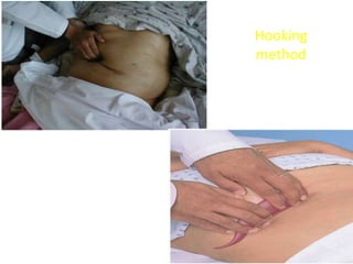 Hooking
method
 