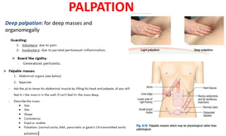 PALPATION
Deep palpation: for deep masses and
organomegally
 