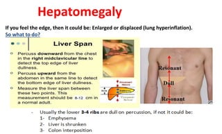 Hepatomegaly
If you feel the edge, then it could be: Enlarged or displaced (lung hyperinflation).
So what to do?
 