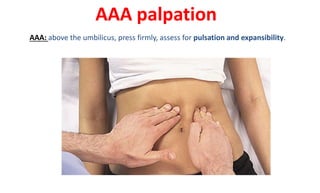 AAA palpation
AAA: above the umbilicus, press firmly, assess for pulsation and expansibility.
 