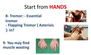 Start from HANDS
8- Tremor: - Essential
tremor
- Flapping Tremor ( Asterixis
): in?
9- You may find
muscle wasting
 