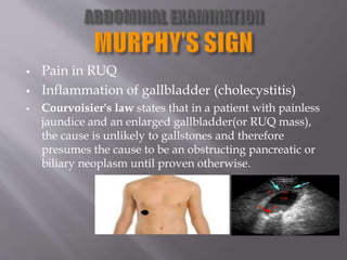  Pain in RUQ
 Inflammation of gallbladder (cholecystitis)
 Courvoisier's law states that in a patient with painless
jaundice and an enlarged gallbladder(or RUQ mass),
the cause is unlikely to gallstones and therefore
presumes the cause to be an obstructing pancreatic or
biliary neoplasm until proven otherwise.
 