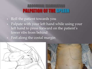  Roll the patient towards you
 Palpate with your left hand while using your
left hand to press forward on the patient’s
lower ribs from behind
 Feel along the costal margin
 
