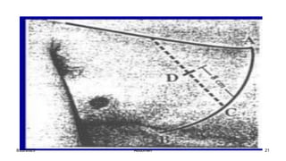 8/22/2023 21
Abdomen
 