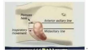 8/22/2023 23
Abdomen
 