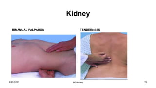 Kidney
BIMANUAL PALPATION TENDERNESS
8/22/2023 26
Abdomen
 