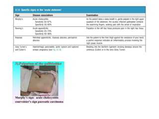 Murray Sign Abdominal examinations .pdf