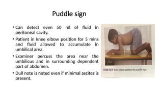 Normal Puddle Sign Abdominal examination. Clinical medicine | PPTX
