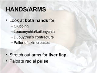 HANDS/ARMS Look at  both hands  for; Clubbing  Leuconychia/koilonychia Dupuytren’s contracture Pallor of skin creases Stretch out arms for  liver flap Palpate radial  pulse 