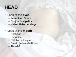 HEAD Look at the  eyes Jaundiced  Sclera Conjunctival  pallor Keiser fleischer rings  Look at the  mouth Dentician Hydration Nutrition – tongue Breath (ketosis/halitosis) Thrush? 