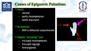 Causes of Epigastric Pulsations
 