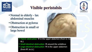 Visible peristalsis
• Normal in elderly - lax
abdominal muscles
• Obstruction at pylorus
• Obstruction in small or
large bowel
 