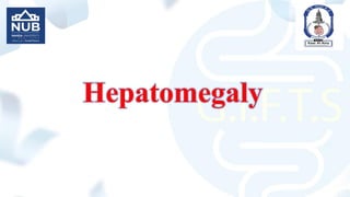 Hepatomegaly
 