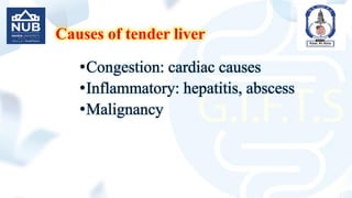 Causes of tender liver
•Congestion: cardiac causes
•Inflammatory: hepatitis, abscess
•Malignancy
 