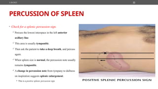 Abdominal examination for C1 medical students | PPTX