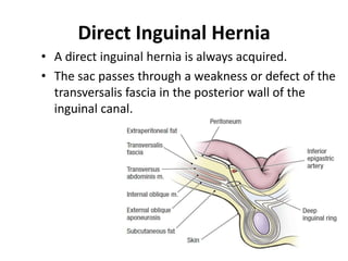 Direct Inguinal Hernia
• A direct inguinal hernia is always acquired.
• The sac passes through a weakness or defect of the
  transversalis fascia in the posterior wall of the
  inguinal canal.
 