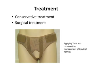 Treatment
• Conservative treatment
• Surgical treatment



                           Applying Truss as a
                           conservative
                           management of inguinal
                           hernias.
 