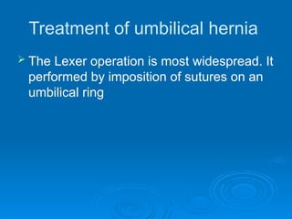 Treatment of umbilical hernia
 The Lexer operation is most widespread. It
performed by imposition of sutures on an
umbilical ring
 