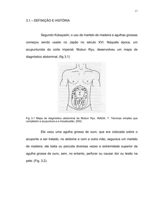 17
3.1 – DEFINIÇÃO E HISTÓRIA
Segundo Kobayashi, o uso de martelo de madeira e agulhas grossas
começou sendo usado no Japão no século XVI. Naquela época, um
acupunturista da corte imperial, Mubun Ryu, desenvolveu um mapa de
diagnóstico abdominal. (fig 3.1)
Fig 3.1 Mapa de diagnóstico abdominal de Mubun Ryu. INADA, T. Técnicas simples que
completam a acupuntura e a moxabustão, 2003.
Ele usou uma agulha grossa de ouro, que era colocada sobre o
acuponto a ser tratado, no abdome e com a outra mão, segurava um martelo
de madeira, ele batia ou percutia diversas vezes a extremidade superior da
agulha grossa de ouro, sem, no entanto, perfurar ou causar dor ou lesão na
pele. (Fig. 3.2).
 