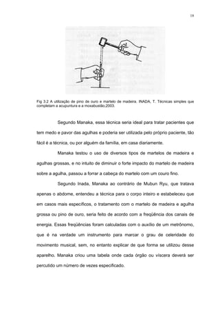 18
Fig 3.2 A utilização de pino de ouro e martelo de madeira. INADA, T. Técnicas simples que
completam a acupuntura e a moxabustão,2003.
Segundo Manaka, essa técnica seria ideal para tratar pacientes que
tem medo e pavor das agulhas e poderia ser utilizada pelo próprio paciente, tão
fácil é a técnica, ou por alguém da família, em casa diariamente.
Manaka testou o uso de diversos tipos de martelos de madeira e
agulhas grossas, e no intuito de diminuir o forte impacto do martelo de madeira
sobre a agulha, passou a forrar a cabeça do martelo com um couro fino.
Segundo Inada, Manaka ao contrário de Mubun Ryu, que tratava
apenas o abdome, entendeu a técnica para o corpo inteiro e estabeleceu que
em casos mais específicos, o tratamento com o martelo de madeira e agulha
grossa ou pino de ouro, seria feito de acordo com a freqüência dos canais de
energia. Essas freqüências foram calculadas com o auxílio de um metrônomo,
que é na verdade um instrumento para marcar o grau de celeridade do
movimento musical, sem, no entanto explicar de que forma se utilizou desse
aparelho. Manaka criou uma tabela onde cada órgão ou víscera deverá ser
percutido um número de vezes especificado.
 