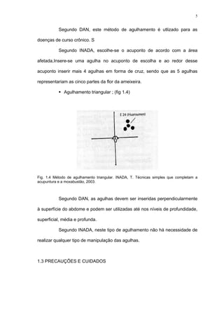 5
Segundo DAN, este método de agulhamento é utlizado para as
doenças de curso crônico. S
Segundo INADA, escolhe-se o acuponto de acordo com a área
afetada,Insere-se uma agulha no acuponto de escolha e ao redor desse
acuponto inserir mais 4 agulhas em forma de cruz, sendo que as 5 agulhas
representariam as cinco partes da flor da ameixeira.
Agulhamento triangular ; (fig 1.4)
Fig. 1.4 Método de agulhamento triangular. INADA, T. Técnicas simples que completam a
acupuntura e a moxabustão, 2003.
Segundo DAN, as agulhas devem ser inseridas perpendicularmente
à superfície do abdome e podem ser utilizadas até nos níveis de profundidade,
superficial, média e profunda.
Segundo INADA, neste tipo de agulhamento não há necessidade de
realizar qualquer tipo de manipulação das agulhas.
1.3 PRECAUÇÕES E CUIDADOS
 