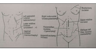 abdominal incision.pptx