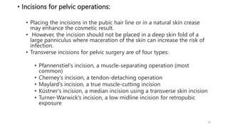 Abdominal Incision Barasima G_121502.pptx