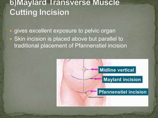  gives excellent exposure to pelvic organ
 Skin incision is placed above but parallel to
traditional placement of Pfannenstiel incision
 