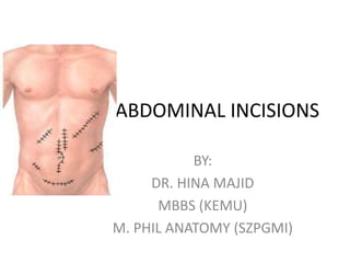 ABDOMINAL INCISIONS
BY:
DR. HINA MAJID
MBBS (KEMU)
M. PHIL ANATOMY (SZPGMI)
 