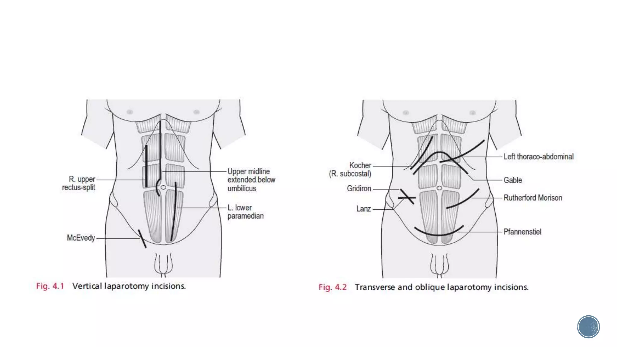 Abdominal Incisions pptx abdominal-incisions-pptx
