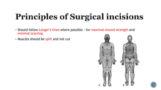  Should follow Langer’s lines where possible – for maximal wound strength and
minimal scarring
 Muscles should be split and not cut
 