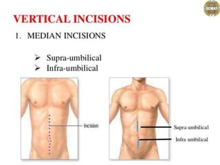.................abdominal incisions.pptx
