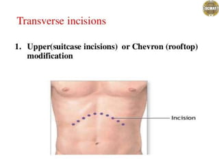 .................abdominal incisions.pptx