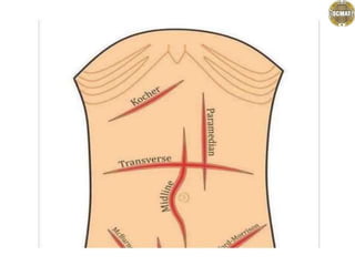 .................abdominal incisions.pptx