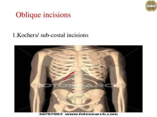.................abdominal incisions.pptx